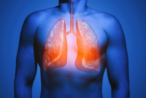 Understanding lung health and disease with pulmonologist Dr. Mahmoud Moammar